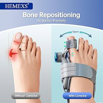 Thumb Valgus Toe Corrector for Men & Women