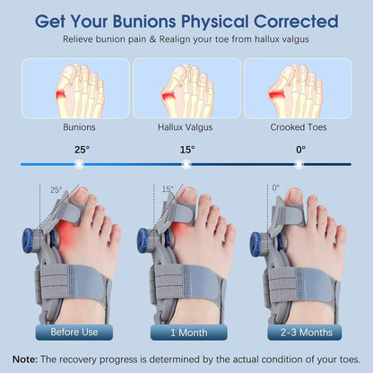 Thumb Valgus Toe Corrector for Men & Women