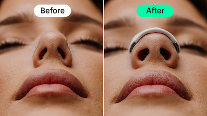 Intake Breathing Nasal Strip